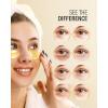 imageUnder Eye Patches 25 Pairs Caffeine Eye Masks for Dark Circles Puffy Eyes Undereye Bags Collagen Eye Patches for Wrinkles and Puffiness Skin Care Gift for HerGold 30 Pairs